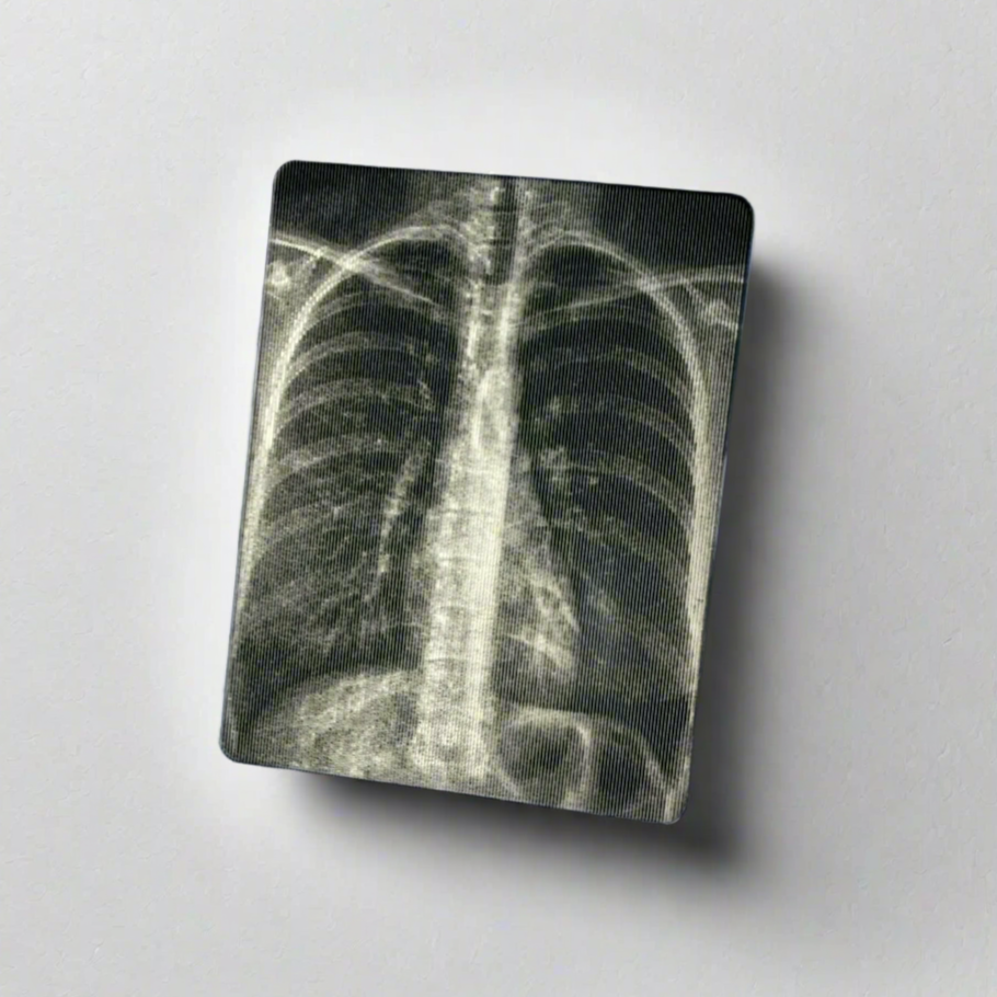 X-rays - Lenticular Swappable Badge Design TOP