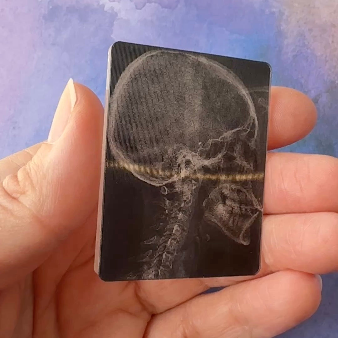 X-rays - Lenticular Swappable Badge Design TOP